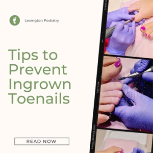 4 Tips to Prevent Ingrown Toenails