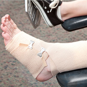 Ankle Sprains in Basketball: Causes, Prevention, and Treatment