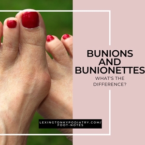 Bunions and Bunionettes: What’s the Difference?