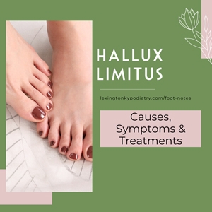 Hallux Limitus: Symptoms, Causes and Treatments