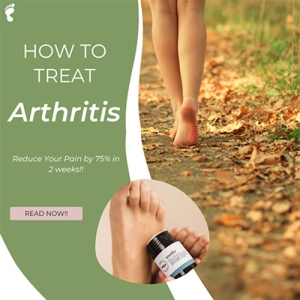 How To Treat Arthritis