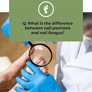 Nail Psoriasis vs. Nail Fungus: Differences & Treatments