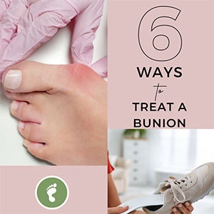 Six Ways to Treat a Bunion