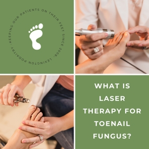 What is Laser Therapy for Toenail Fungus?