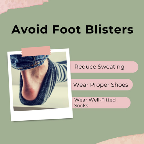 How To Prevent Foot Blisters