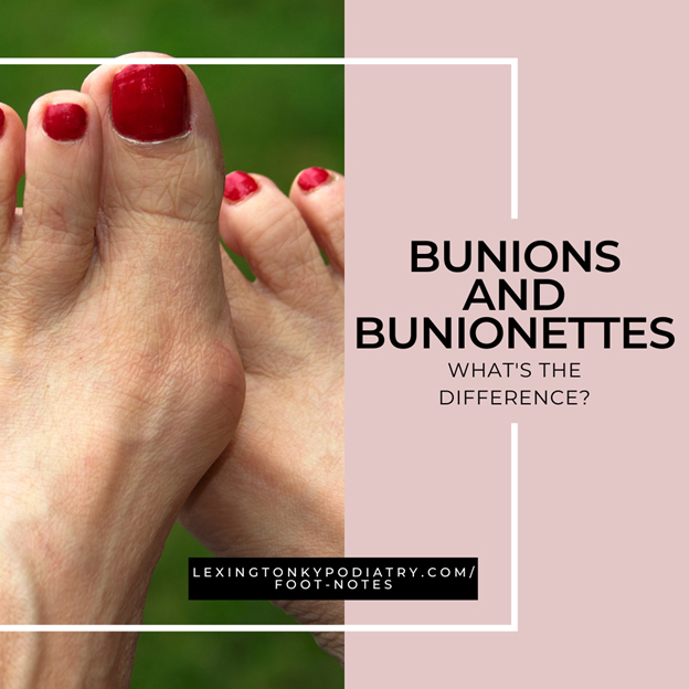 Bunions and What’s the Difference?